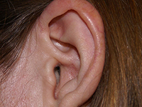 Picture of an ear